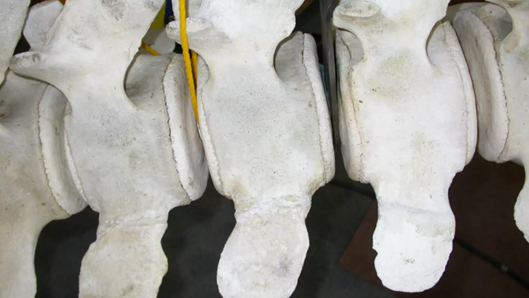 The lumbar vertebrae had healed processes that might indicate an injury that could have eventually contributed to the whale’s death.